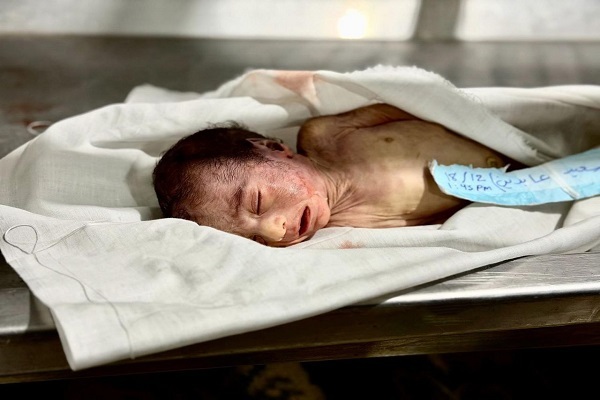 12 شهید و 7 زخمی در غزه طی 48 ساعت گذشته