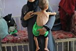 UNICEF: 112 bambini di Gaza vengono diagnosticati con malnutrizione acuta ogni giorno