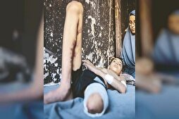 Gazze'de yeni rapor: Her gün 30 Filistinli engelli oluyor